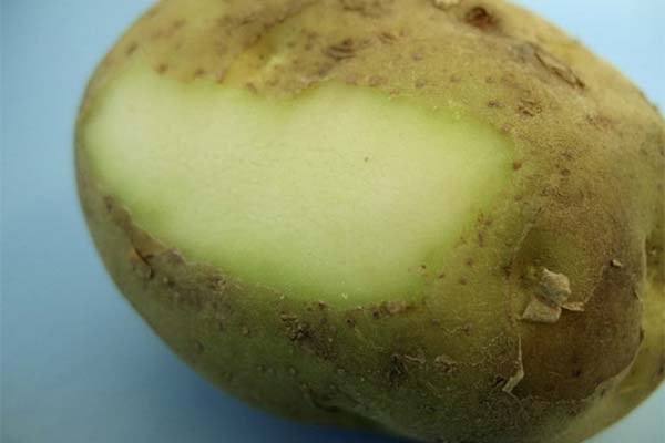 Oznaki zatrucia zielonym ziemniakiem u ludzi
