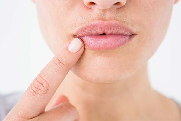 Co zrobić z pęknięciami w kącikach ust